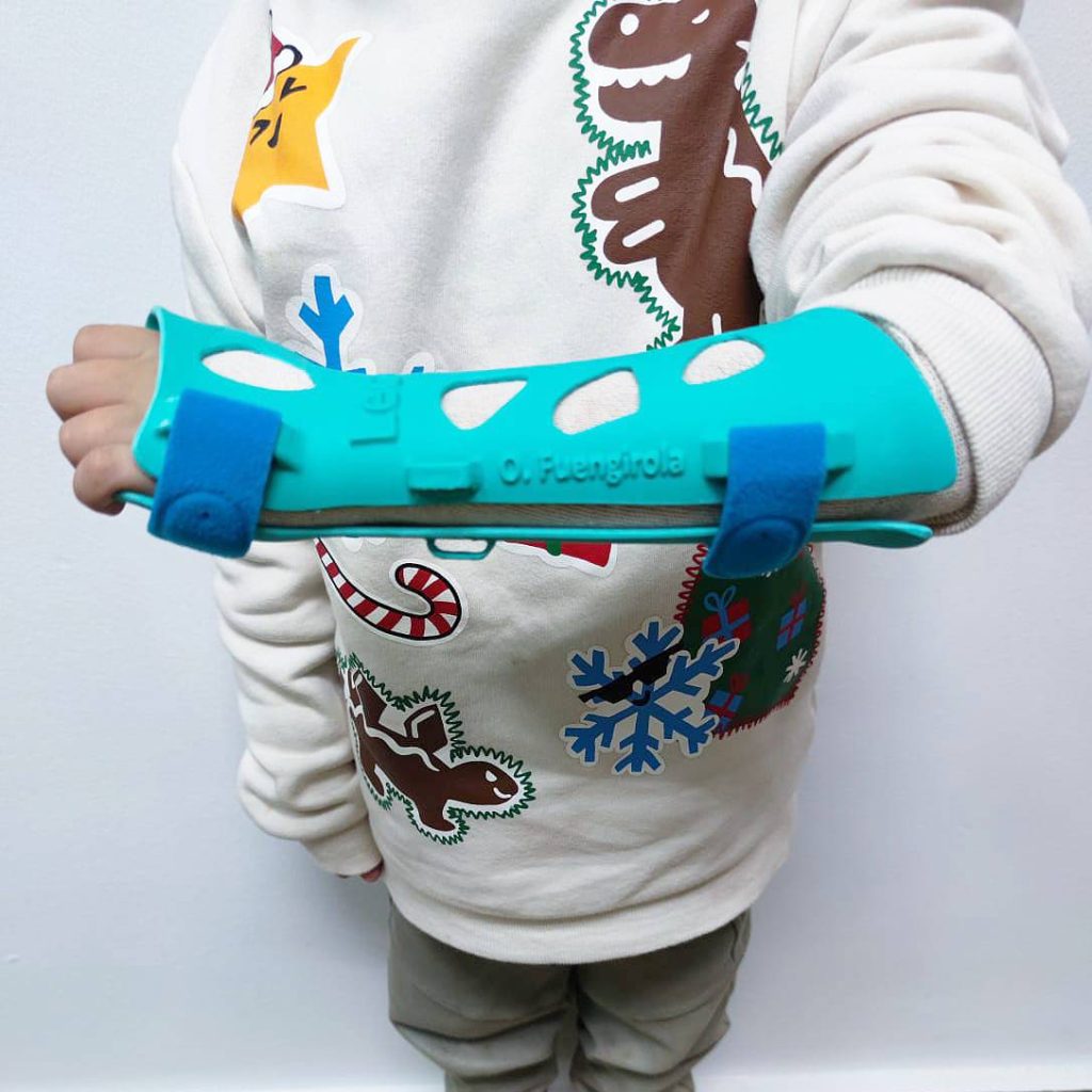ortopedia infantil en fuengirola